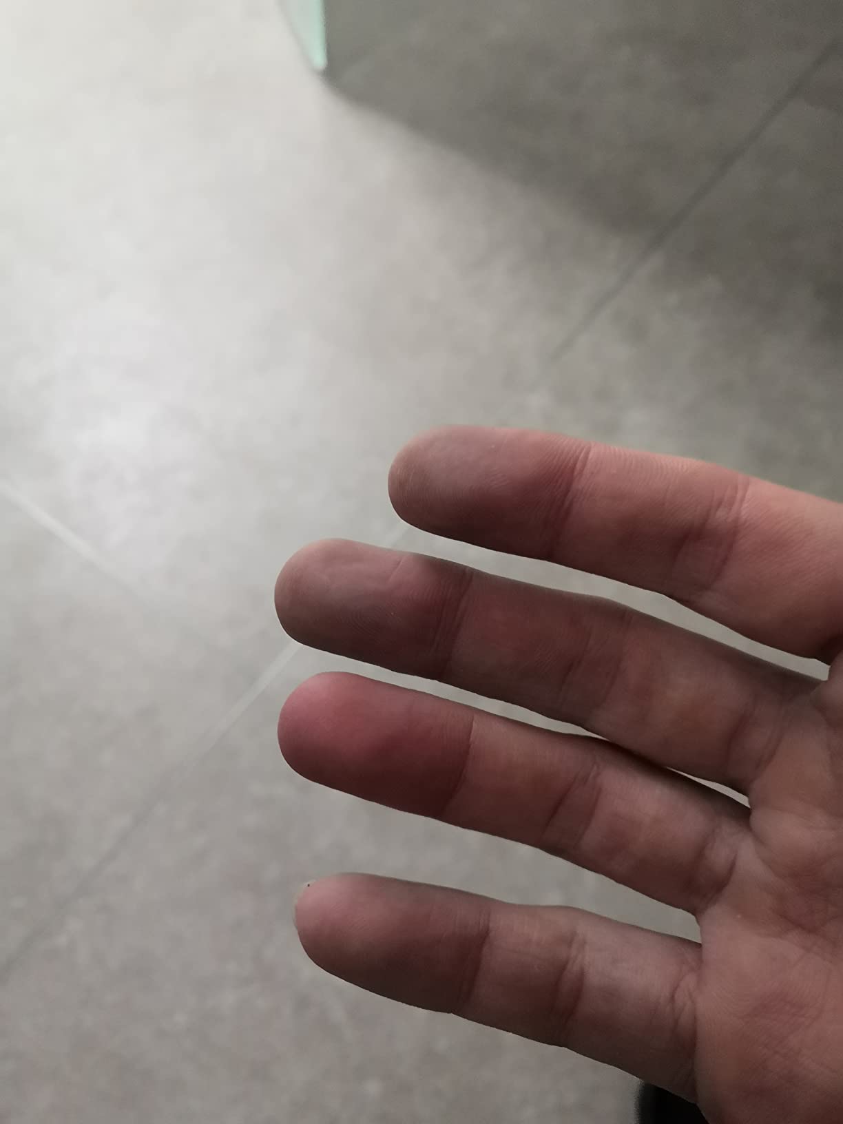 Endlich keine kalten Finger